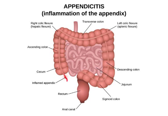 Appendix illustration